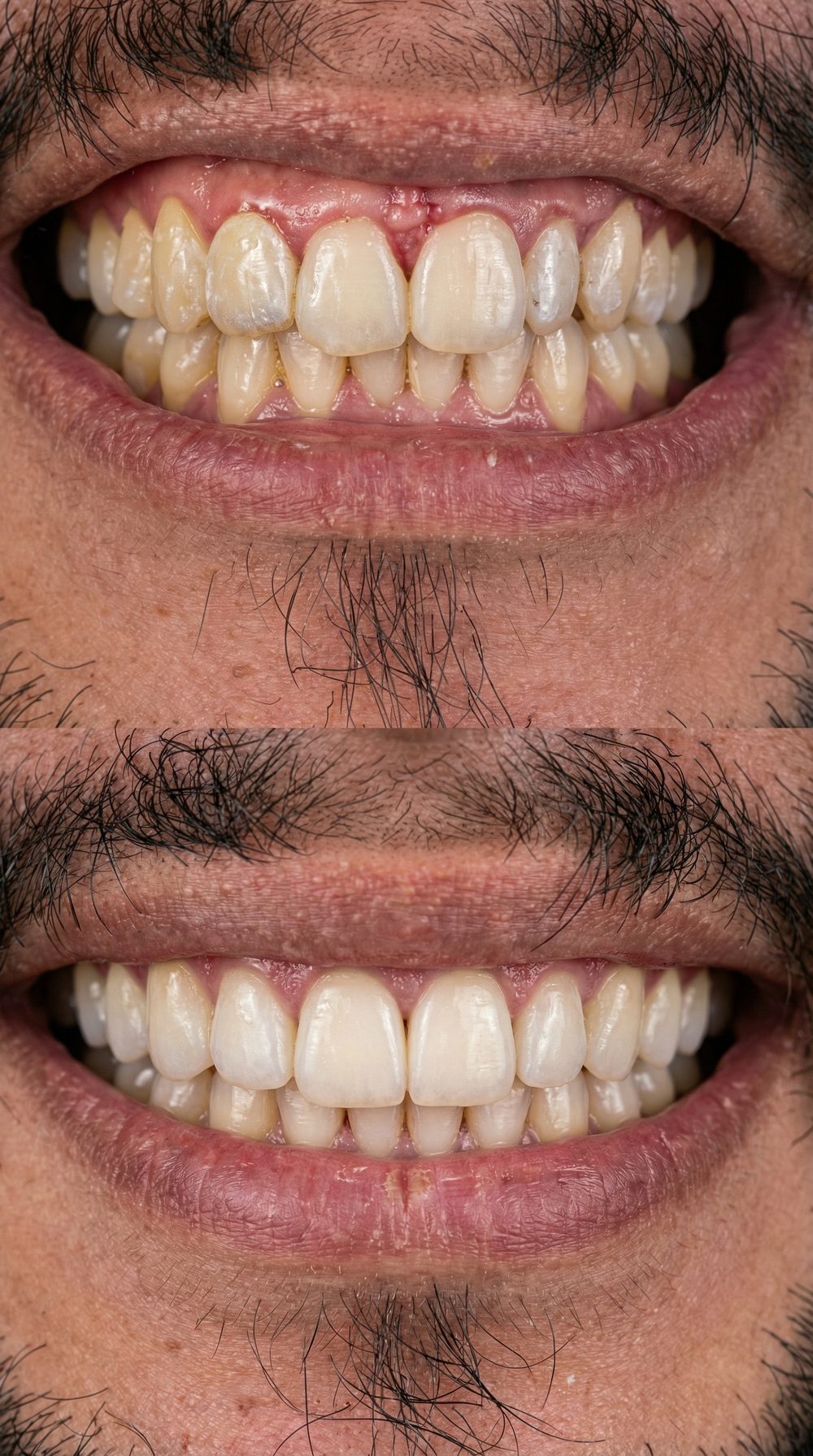 Caso real: antes y después de rehabilitación dental en Müller Clinic