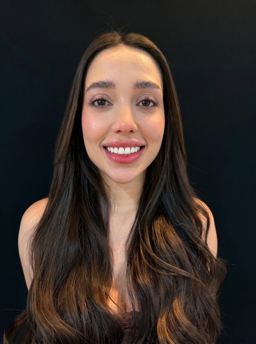 Caso real: antes y después de estética dental en Müller Clinic